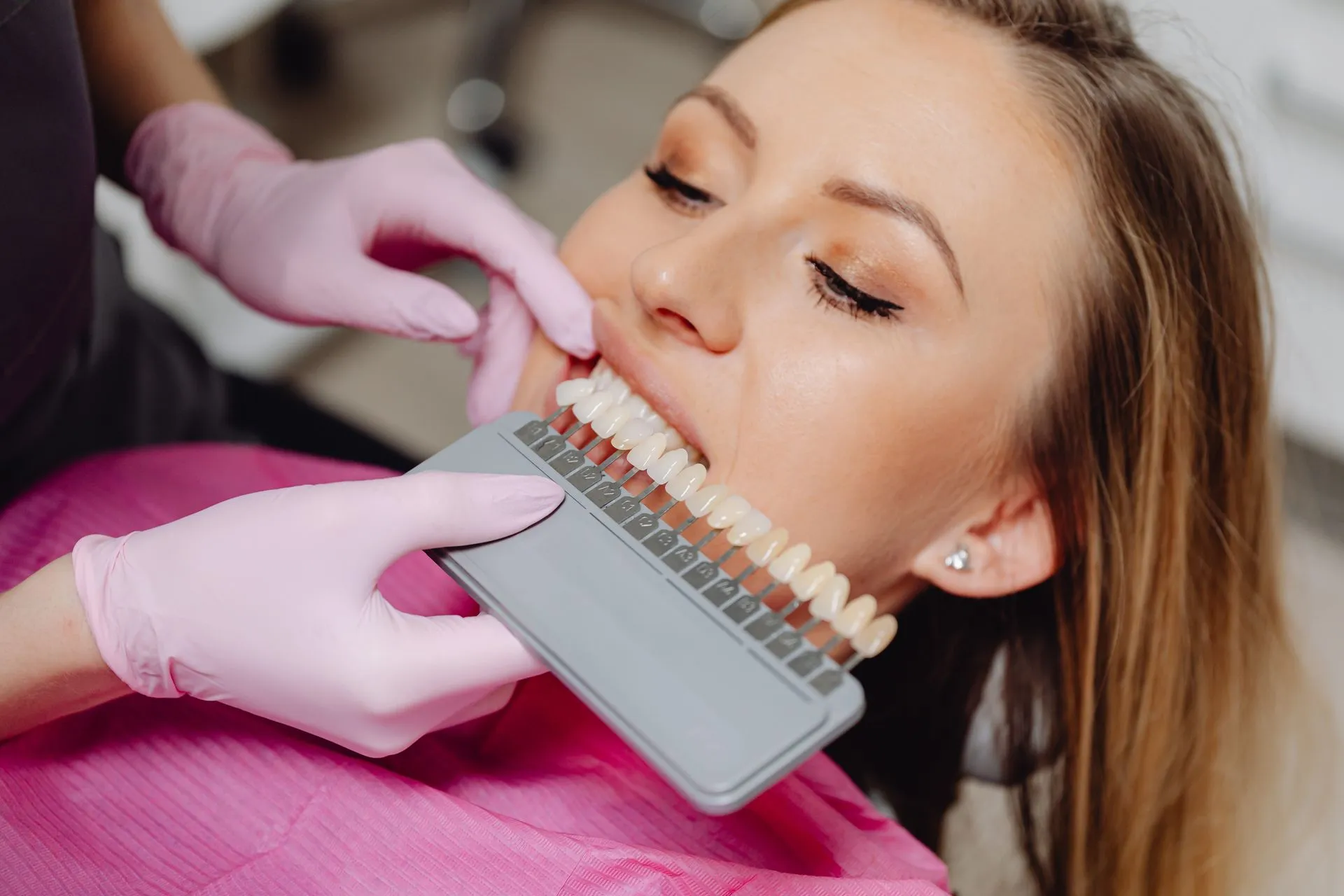 Selección del tono de dientes con una guía de color durante un tratamiento de estética dental